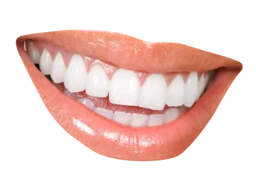 a woman's mouth with white teeth