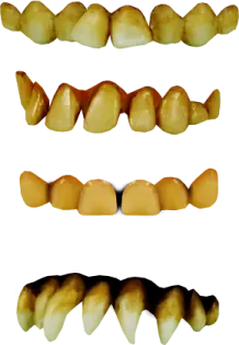 a set of teeth with different angles