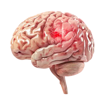 an image of the human brain