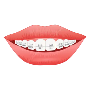a woman's mouth with braces