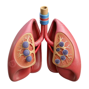 a diagram of the lungs