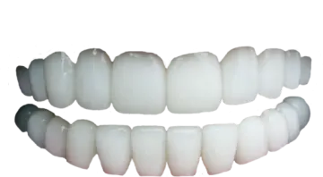 a close up view of the front and back teeth