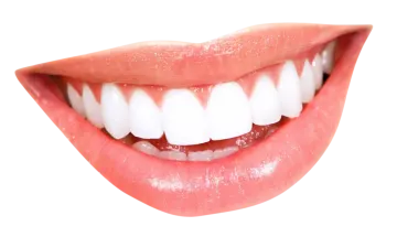 a woman's mouth with white teeth