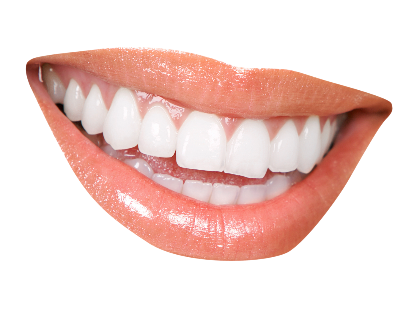 a woman's mouth with white teeth