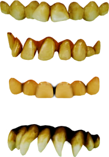 a set of teeth with different angles