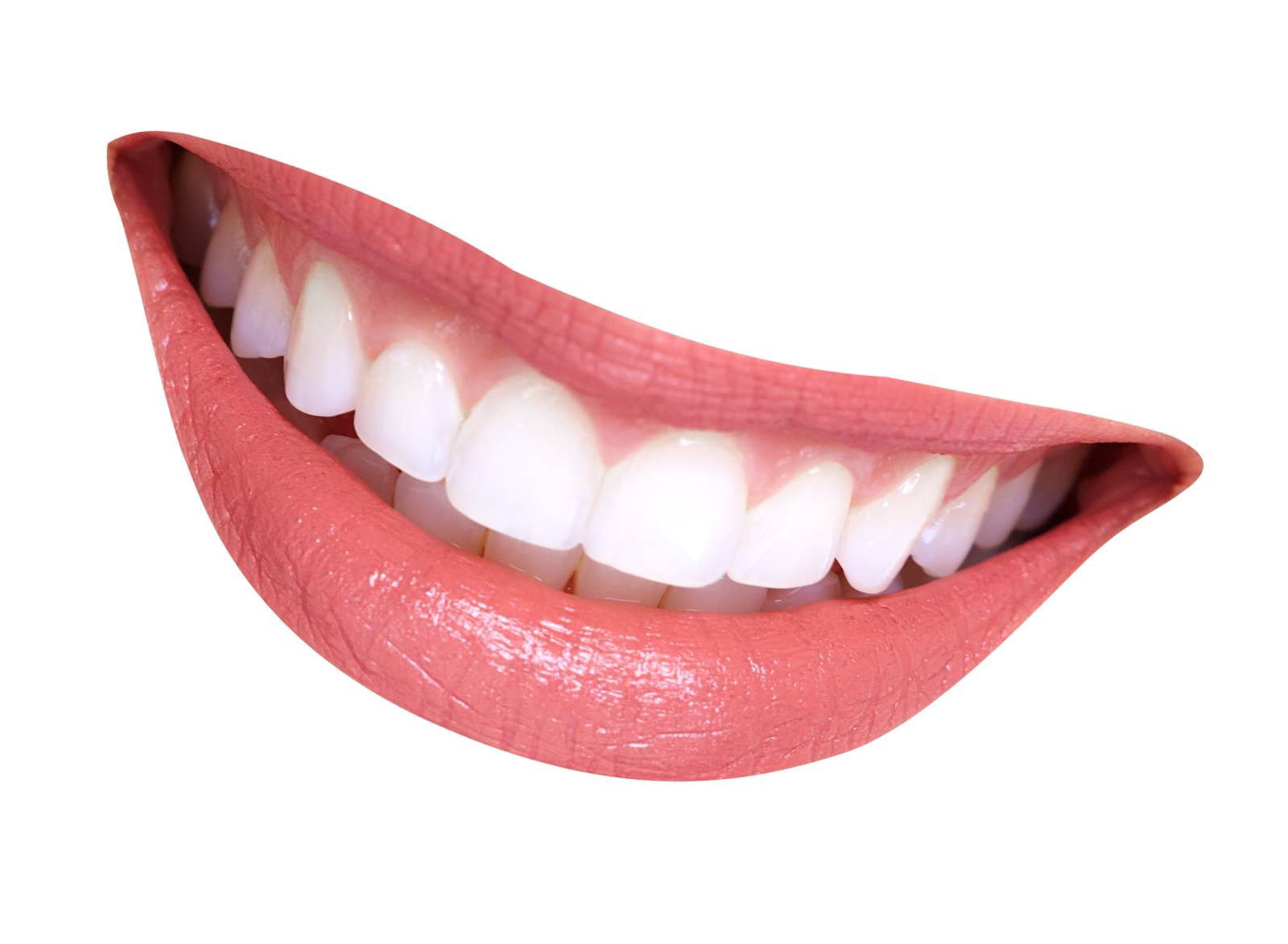 a woman's mouth with white teeth