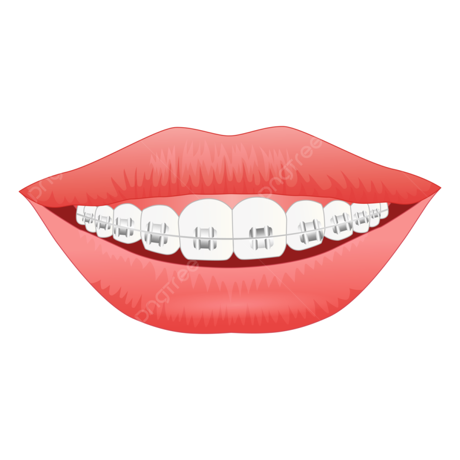 a woman's mouth with braces
