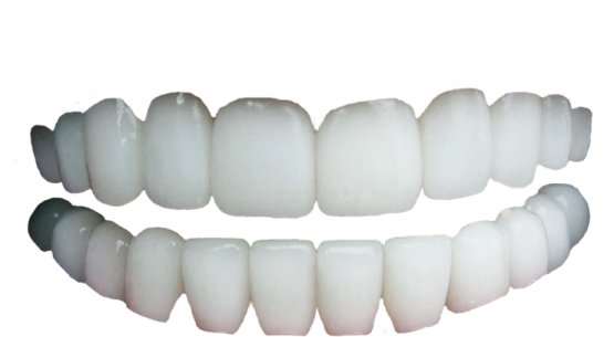 a close up view of the front and back teeth