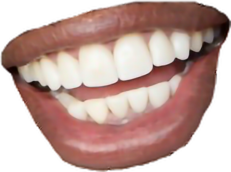 a woman's mouth with white teeth