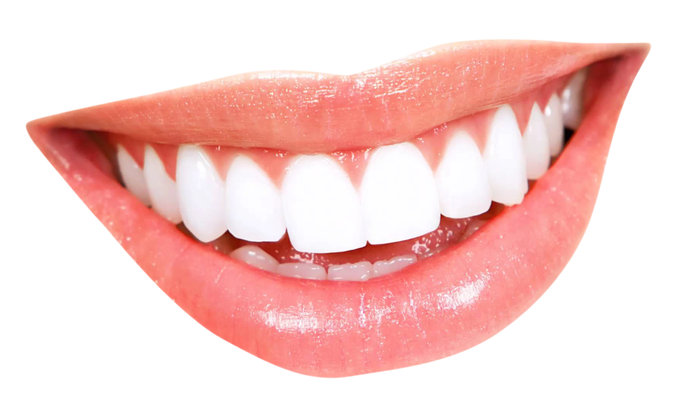 a woman's mouth with white teeth